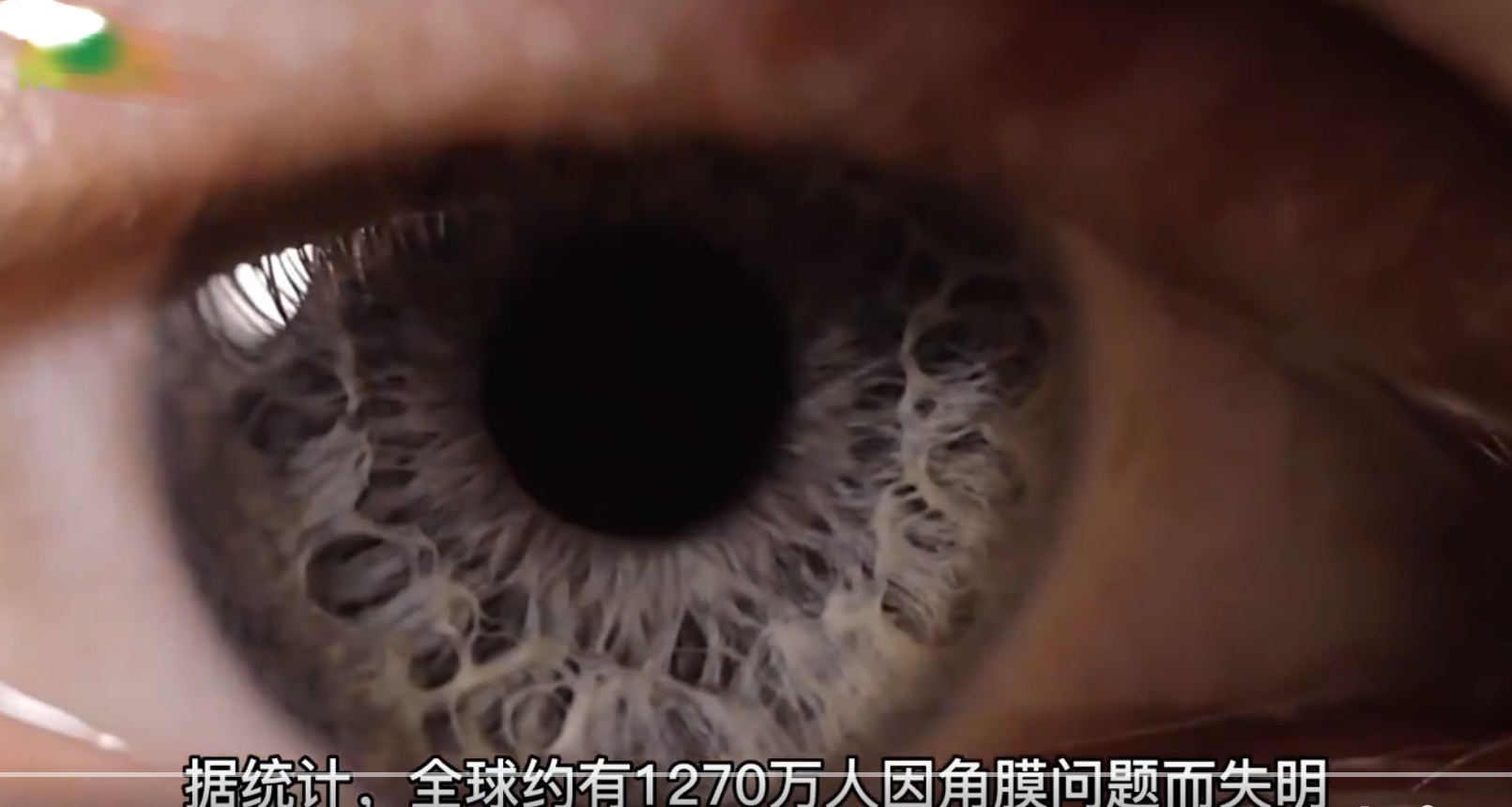 科学家用猪皮恢复盲人视力 猪皮的功效与作用不只是吃了？(图1)